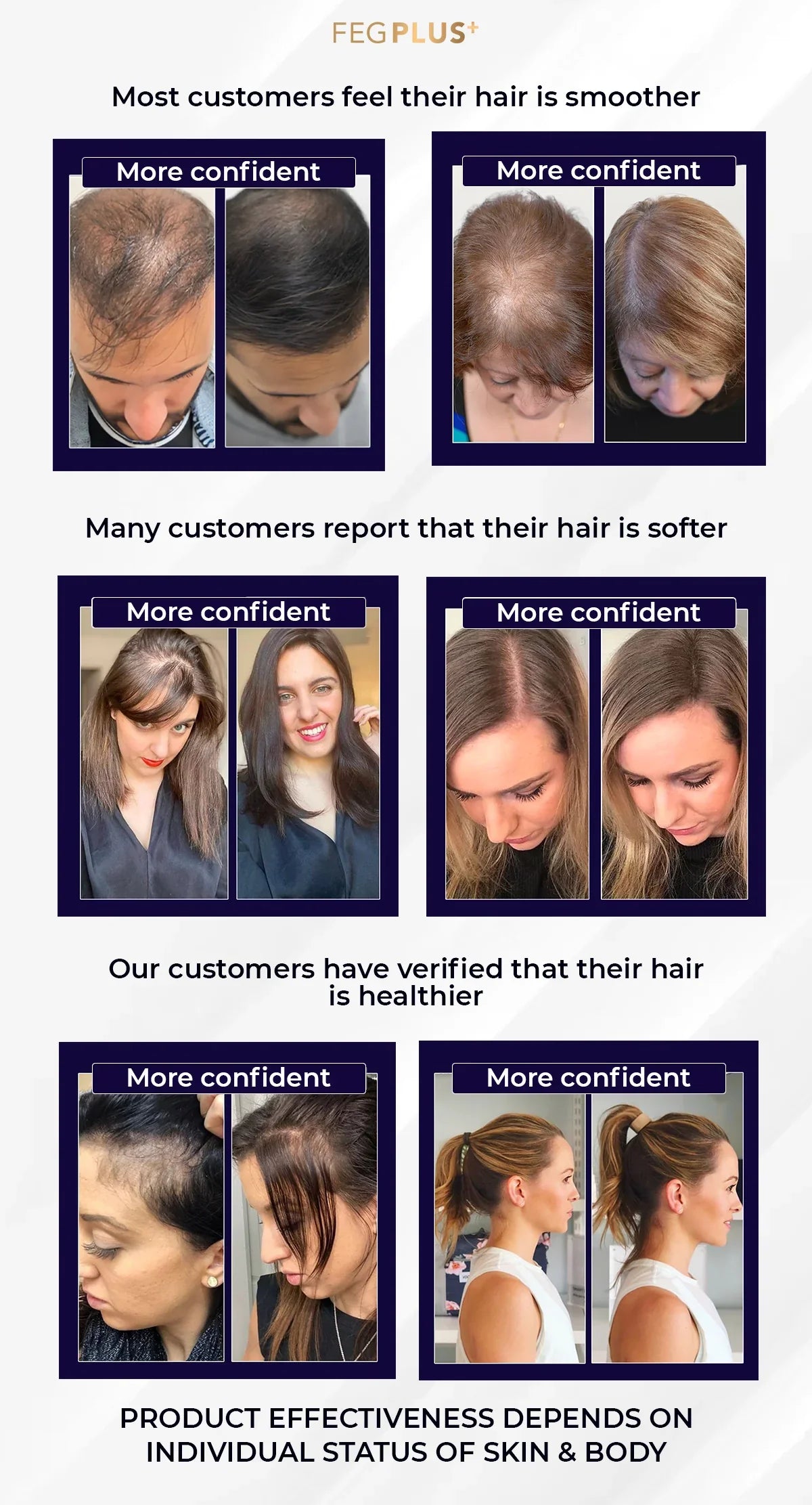 FEG Plus Hair Growth Spray (Original) - AR Store