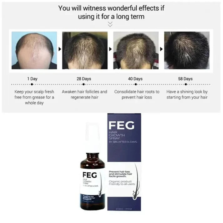 FEG Plus Hair Growth Spray (Original) - AR Store