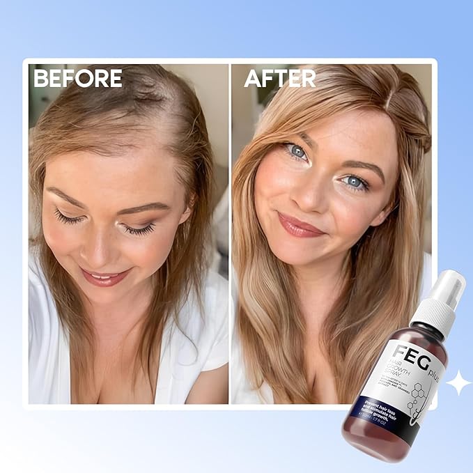 FEG Plus Hair Growth Spray (Original) - AR Store